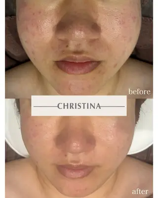 DahliaBeauty ダリアビューティー所属・DahliaBeau tyフェイシャル中村のエステ・リラクイメージ