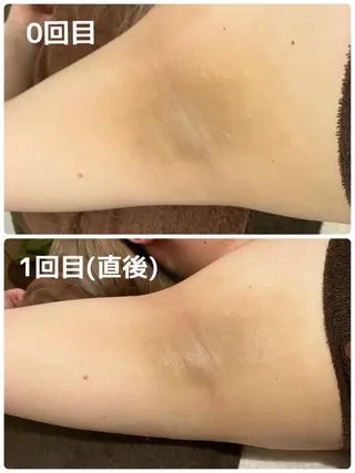 SALON BioBioのエステ・リラクイメージ