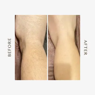 メンズ Amm所属・🏆艶肌ワックス🏆 ララピール✨Ammのエステ・リラクイメージ