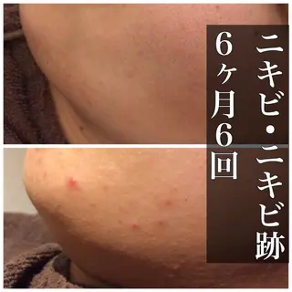 ミディアム カラー パーマ ヘアアレンジ メンズ キッズ ネイル マツエク・マツパ ニキビ・肌質改善専門 ♡人生が変わるサロンのエステ・リラクイメージ