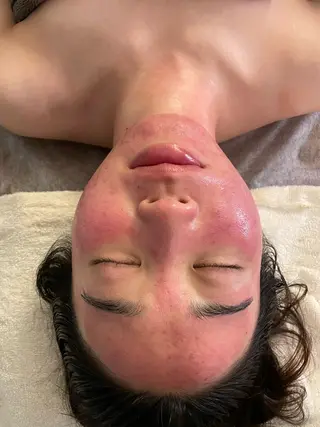 耳ツボ/体質改善/ 温活La mer月島のその他イメージ