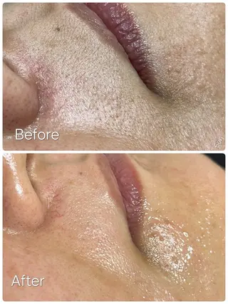 シュガーリング/脱毛 EARLS三軒茶屋のエステ・リラクイメージ