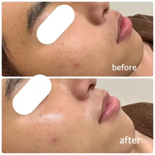 メンズ 今西 彩夢のエステ・リラクイメージ