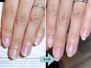 ネイル 深爪矯正・自爪育成 ネイルサロンアモここのネイルデザイン