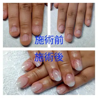 ネイル 島屋 千奈美のネイルデザイン