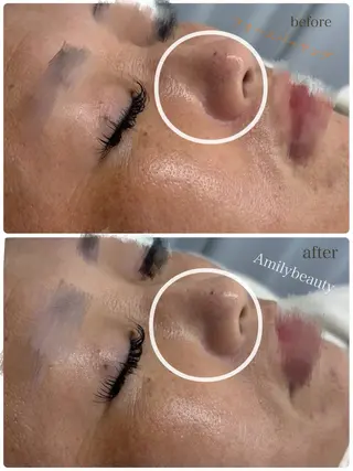 Amilybeauty所属・Amily beauty 毛利のその他イメージ