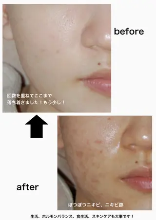 M. lisyelのエステ・リラクイメージ