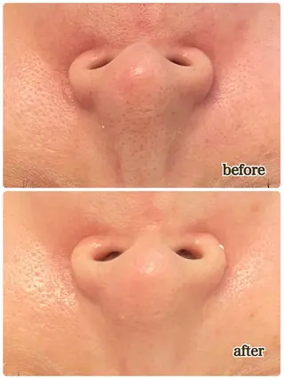 鹿の子台 プライベートサロン 芹花〜SERIKA〜所属・稲角 芹香のエステ・リラクイメージ