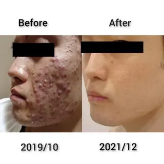 心身の緊張を解く⭐️ Harmonicsのエステ・リラクイメージ