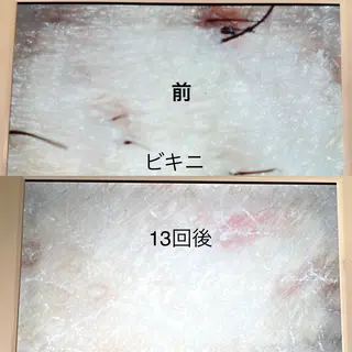 Thu Huyen Beauty所属・トウ フェンのエステ・リラクイメージ