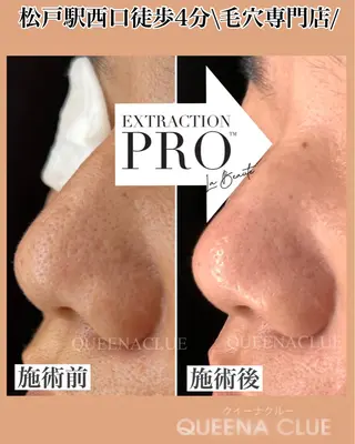 毛穴改善/脱毛 ネイル　川上久仁子のエステ・リラクイメージ