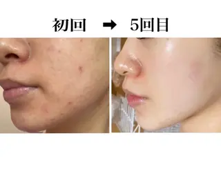 hm NATURESKINのエステ・リラクイメージ