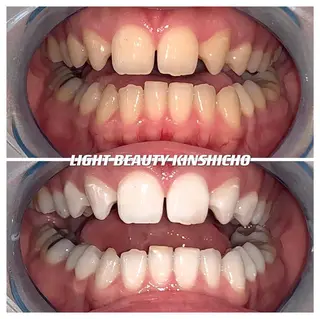 ライトビューティー 錦糸町店のエステ・リラクイメージ