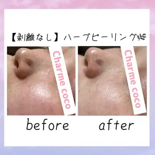肌質改善Charme coco  増毛のエステ・リラクイメージ