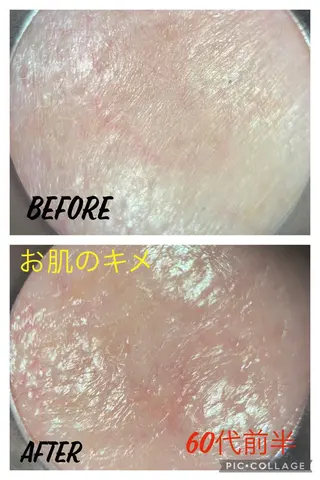 ハウオリベリー所属・うえば すみかのエステ・リラクイメージ