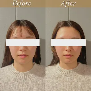 美容鍼灸整体サロンBeAu所属・美容鍼灸師 川口 愛華のエステ・リラクイメージ