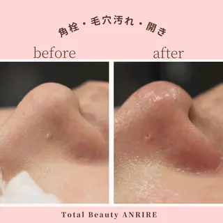 ANRIRE (アンリール)のエステ・リラクイメージ