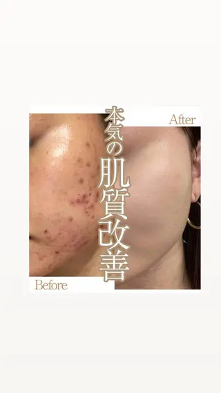 La natura所属・松崎 うみのエステ・リラクイメージ