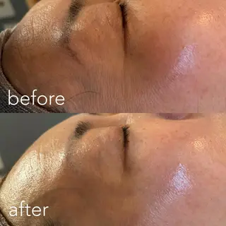 エステティックサロン Liente(リアンテ)所属・Hashimoto .のエステ・リラクイメージ