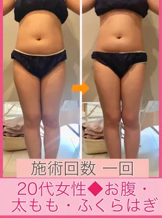 ミディアム カラー パーマ ヘアアレンジ メンズ キッズ ネイル マツエク・マツパ ‍痩身＆ボディ 結果出し🌟丹野のエステ・リラクイメージ