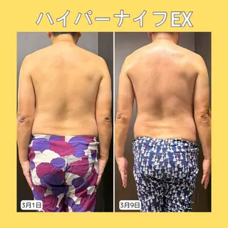 赤澤/本気痩せ・脱毛 ・ノーファンデ肌のその他イメージ