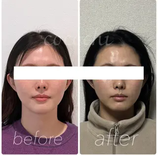 小顔と ヘッドスパのお店のエステ・リラクイメージ