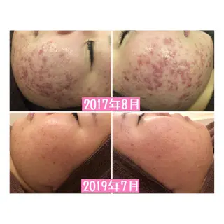 ショート カラー パーマ ヘアアレンジ メンズ キッズ ネイル マツエク・マツパ ニキビ・肌質改善専門 ♡人生が変わるサロンのエステ・リラクイメージ