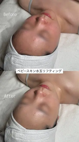 韓国肌管理🫧LDM 🫧Junnaのエステ・リラクイメージ