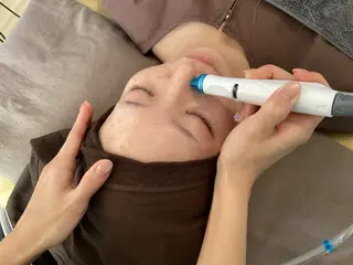 ニキビ特化美容鍼 ×ハーブピーリングのエステ・リラクイメージ