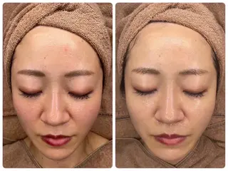 中目黒ハーブピーリン グ🌿ララピールのエステ・リラクイメージ