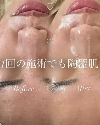 miki 東根の肌質改善サロンのエステ・リラクイメージ