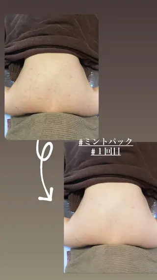 陽 月のエステ・リラクイメージ