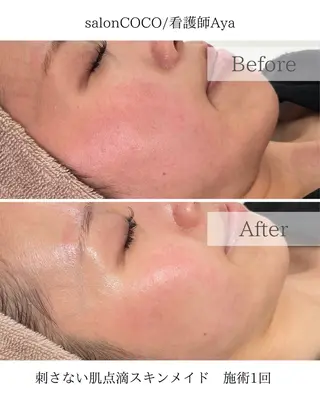 salonCOCO所属・肌管理看護師💎 salonCOCOのエステ・リラクイメージ