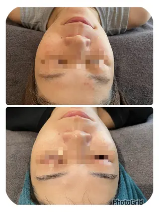 【リベルハーブピーリング認定店】敏感肌・美白脱毛専門店Dione立川店所属・Dione 立川店のエステ・リラクイメージ