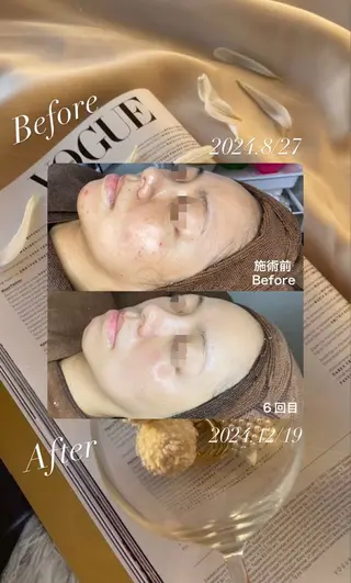 Lattina beautysalon所属・Lattina ラティーナのエステ・リラクイメージ