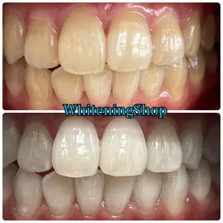 ホワイトニング ショップ吉祥寺店のエステ・リラクイメージ