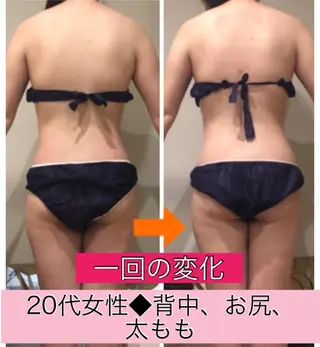 ロング カラー パーマ ヘアアレンジ メンズ キッズ ネイル マツエク・マツパ ‍痩身＆ボディ 結果出し🌟丹野のエステ・リラクイメージ