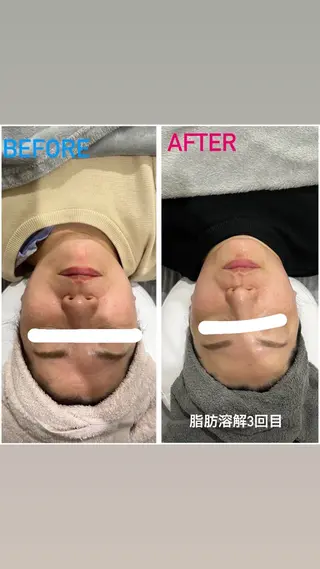 アルカンジュ~archange~所属・痩身/毛穴洗浄/脱毛 アルカンジュのエステ・リラクイメージ