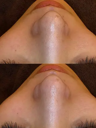 EARTH coiffure beaute 新潟紫竹山店所属・🤍アベシュリ /フェイシャル🤍のエステ・リラクイメージ