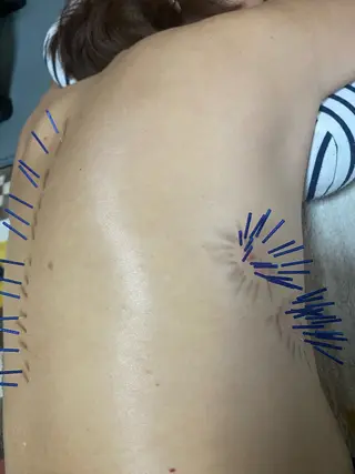 さや 鍼灸院のその他イメージ