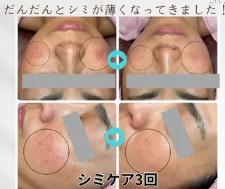 肌質改善エステ chiffonのエステ・リラクイメージ