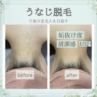 🎀美肌サロン レイビス川崎店🎀のエステ・リラクイメージ