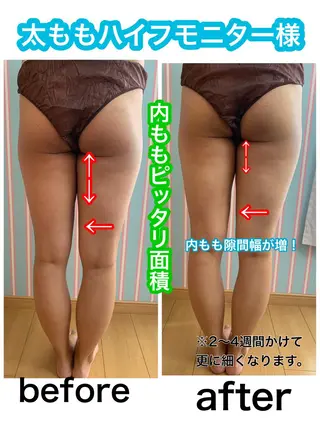 痩身/脱毛/ネイル HARUKAのエステ・リラクイメージ