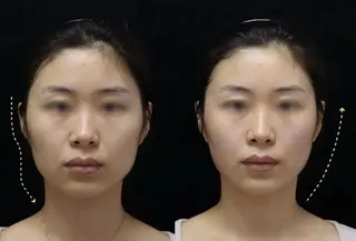 マツエク・マツパ aliaハイフ&水光ジェットサロン所属・aliaハーブ水光店 エステティシャン募集のエステ・リラクイメージ