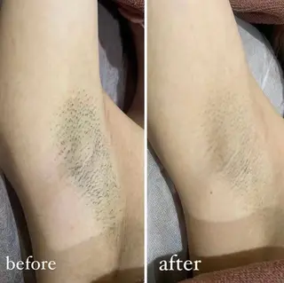 メルシー13所属・トータル美容サロン☆ 脱毛/小顔/毛穴洗浄のエステ・リラクイメージ