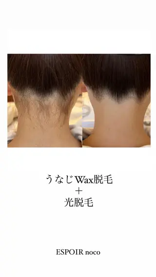 ワックス脱毛🌈 ESPOIRnocoのエステ・リラクイメージ