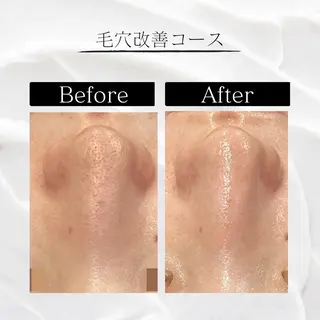 NAYU/レディース 眉毛/堺筋本町の眉毛・アイブロウイメージ