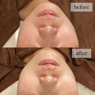 HINANO矢場町店【ヒナノ】所属・脱毛/肌改善🌿 HINANO 村田のエステ・リラクイメージ