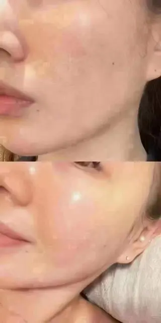 マツエク・マツパ aliaハイフ&水光ジェットサロン所属・aliaハーブ水光店 エステティシャン募集のエステ・リラクイメージ