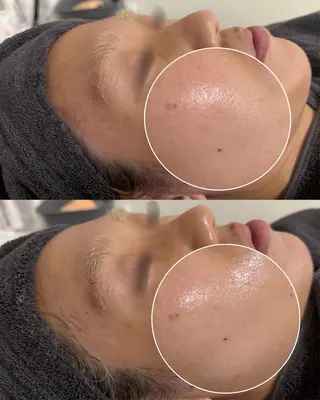 メンズ laksmi 陶肌トリートメントのエステ・リラクイメージ